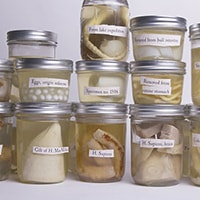Organ Specimen Jars
